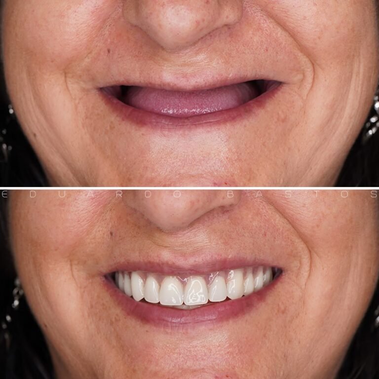 3c437a82ee72a9ce62183fa4cb6d3d9e