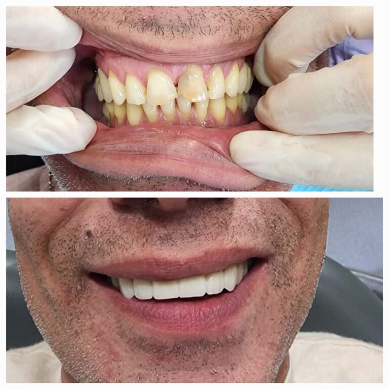 WhatsApp Image 2025-04-11 at 17.53.01 (1)