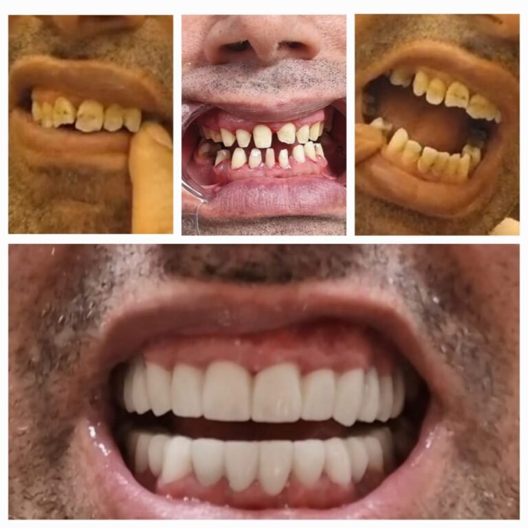 WhatsApp Image 2025-04-11 at fff17.52.53